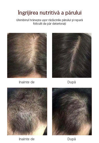 Oveallgo™ | Îmbunătățește-ți creșterea părului în mod natural