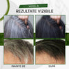 REFRESSPRO™ | Refaceți-vă culoarea naturală a părului (1+1 GRATUIT)